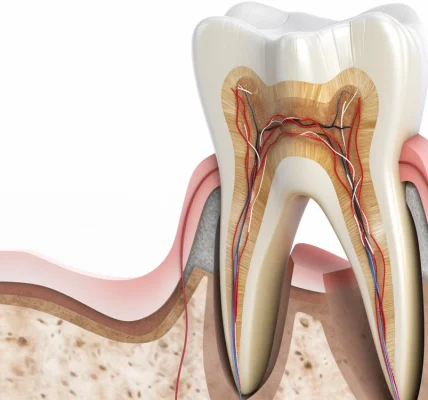 Leczenie kanałowe martwego zęba